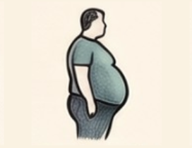 Obesidad como factor de riesgo de hernia abdominal
