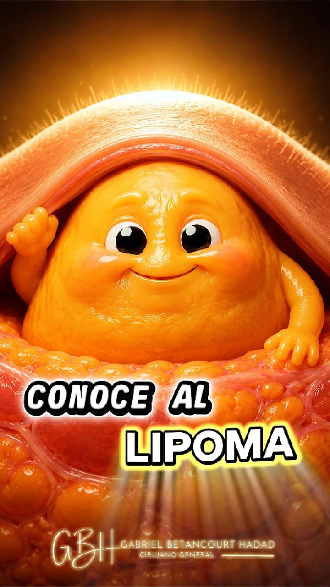 Lipomas