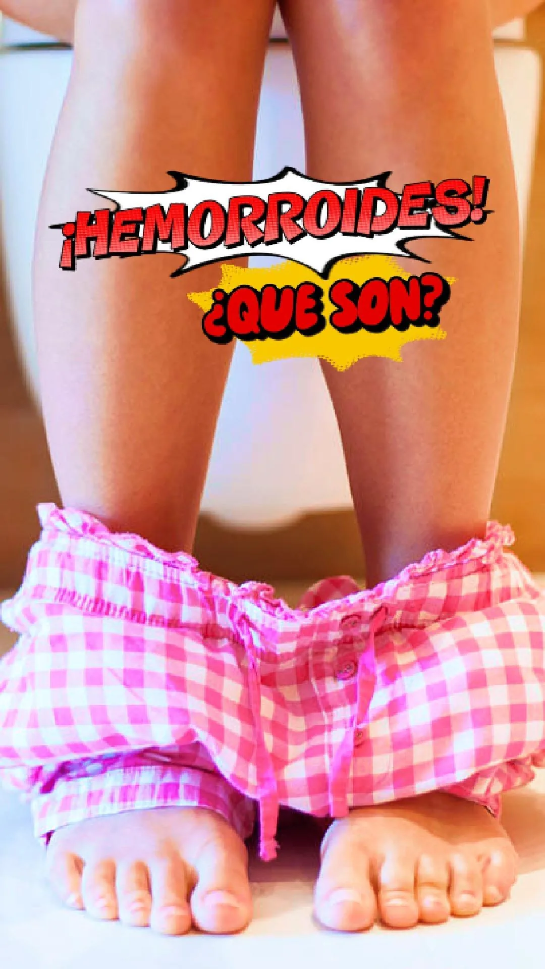 ¿Qué son las hemorroides?