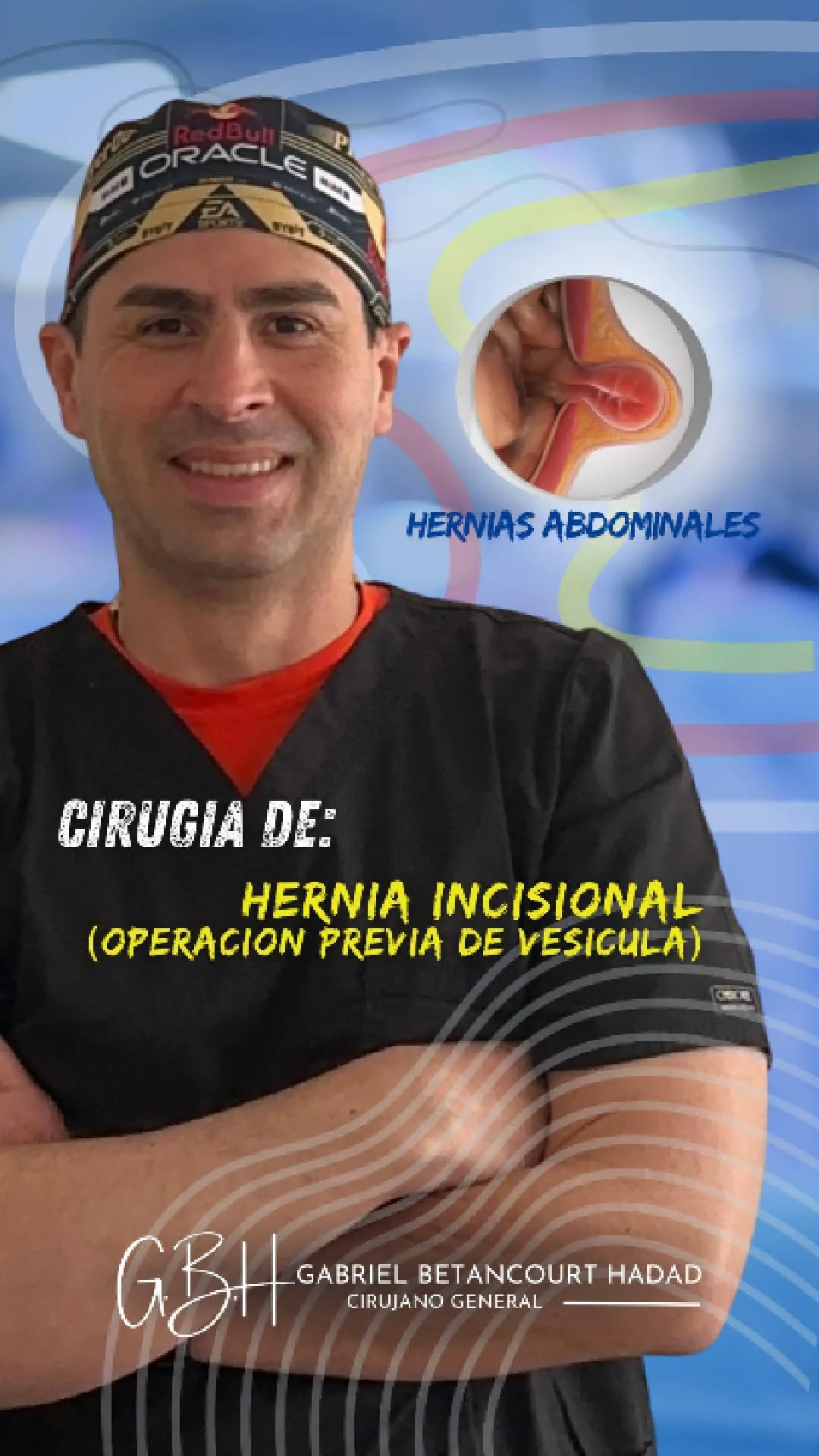Hernia incisional