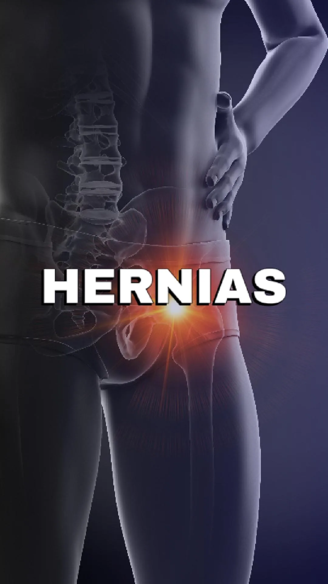 ¡Hernias!